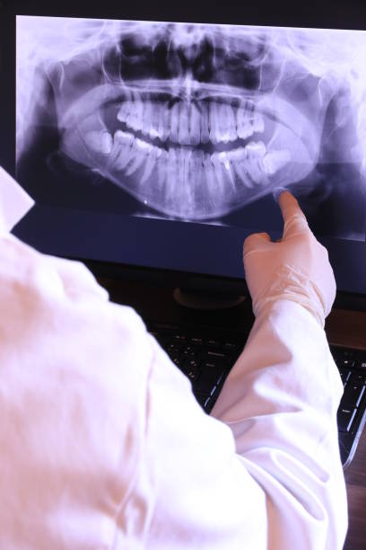 Best Emergency Dental Services for Seniors in Stirling, NJ